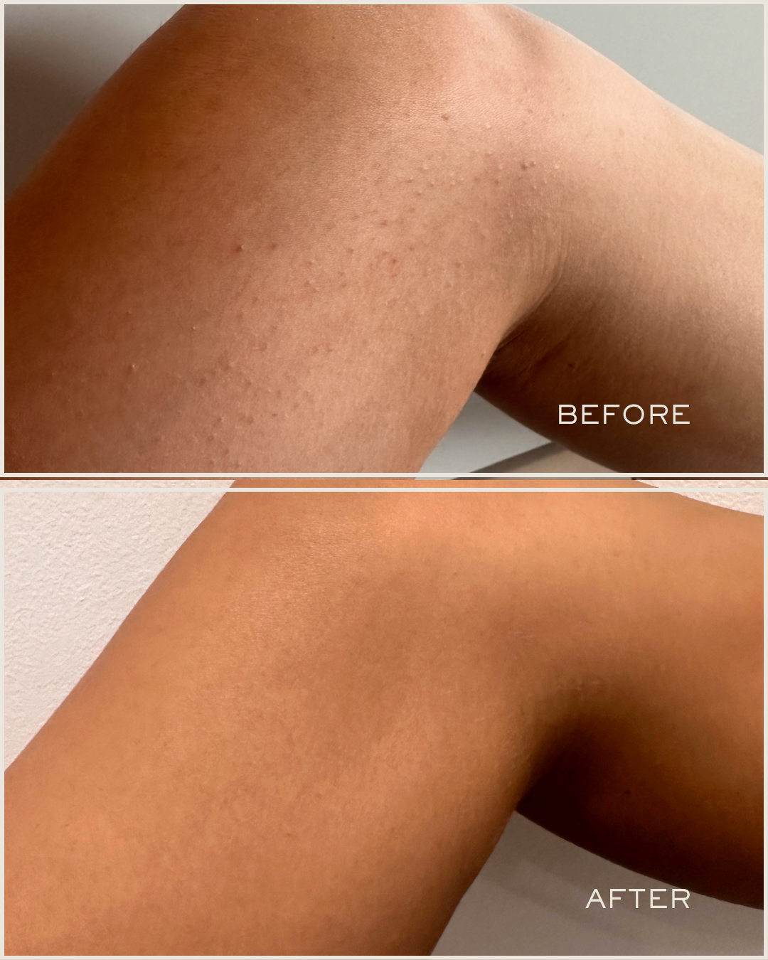 Tronque | Exfoliating Body Serum